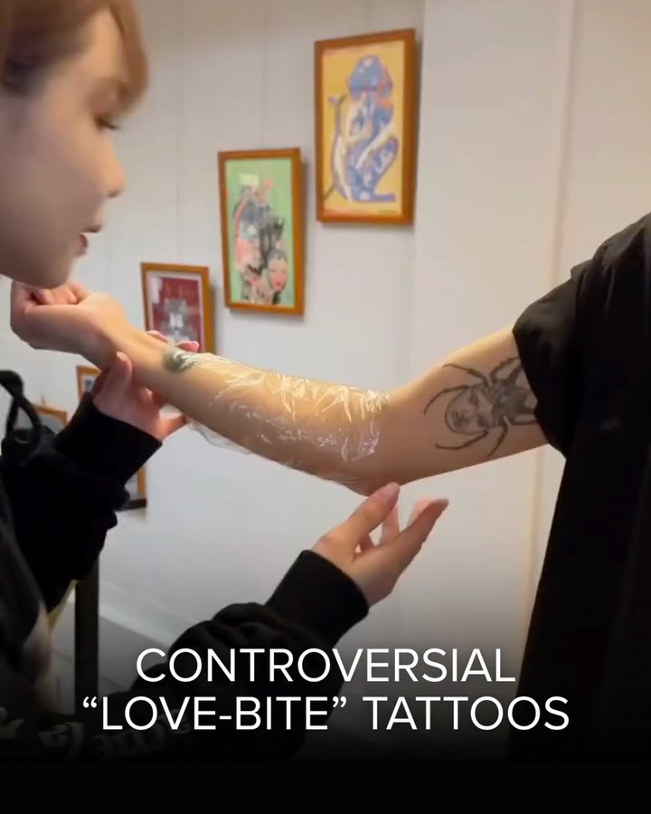 Controversial Love-Bite Tattoo