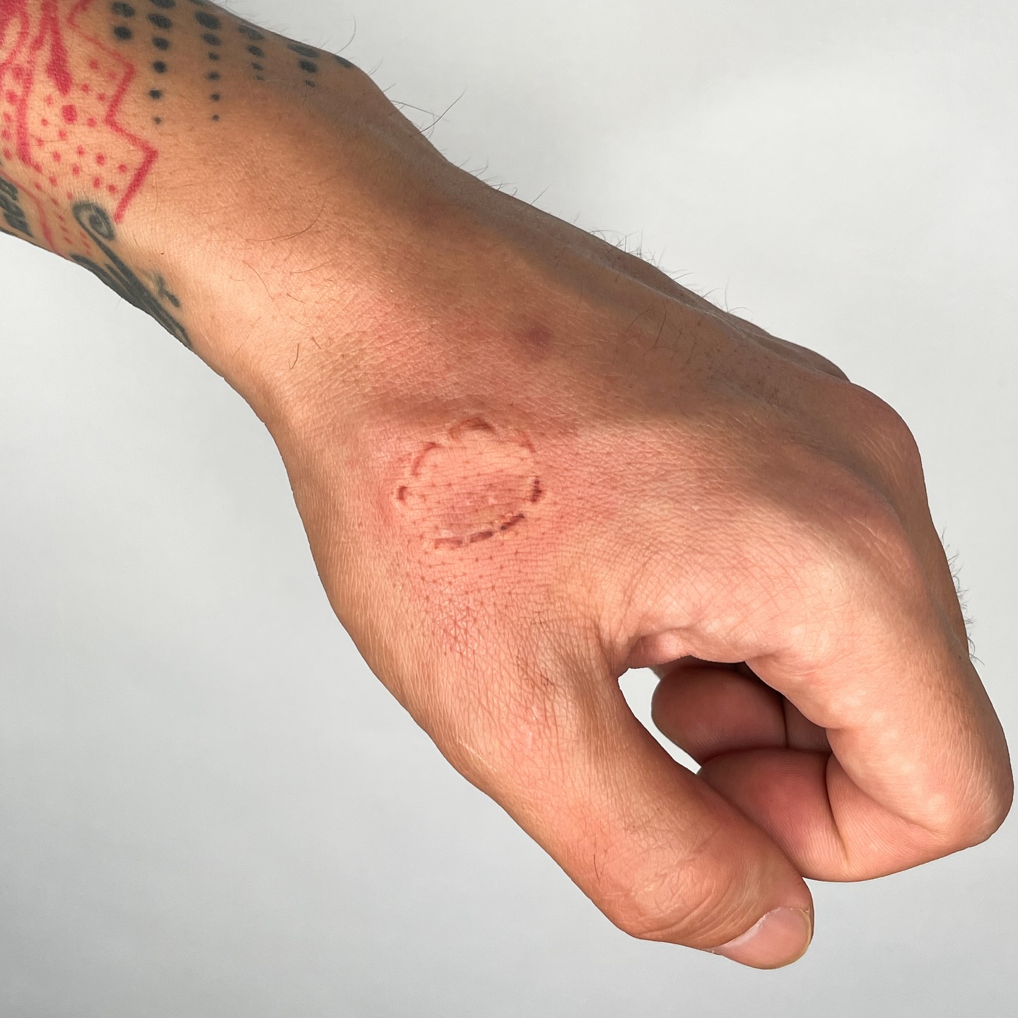 Realistic Bite Mark Scar