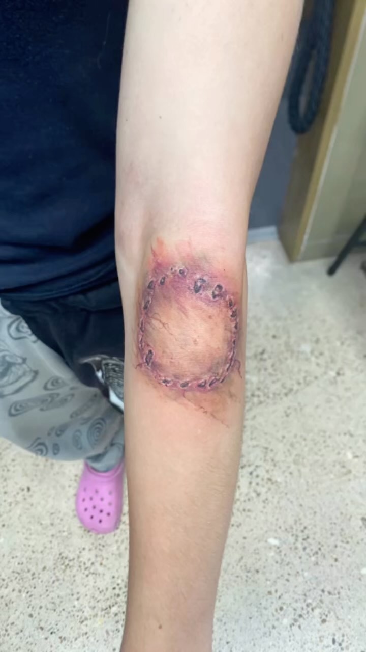 Realistic Bite Mark Tattoo