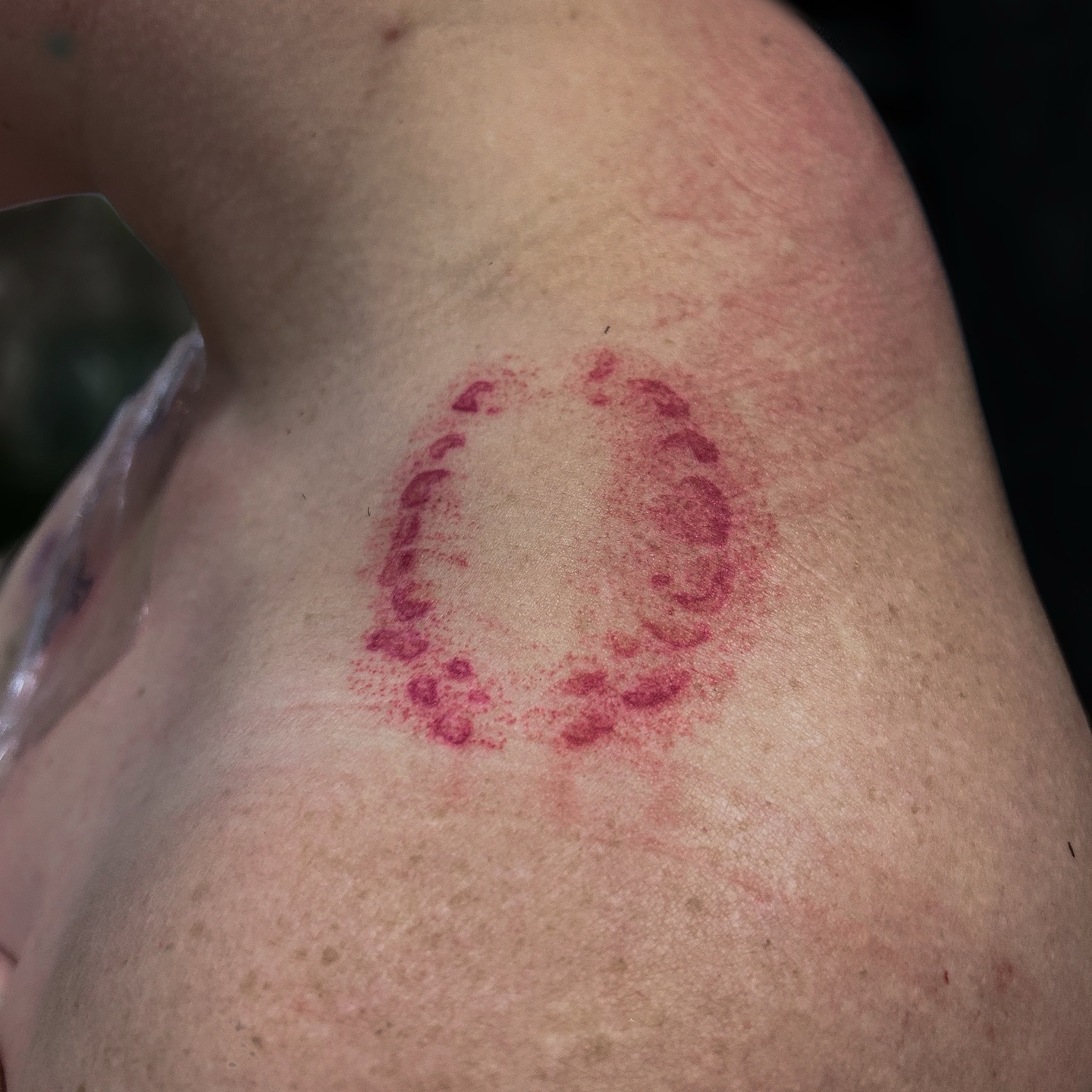 Realistic Bite Mark Tattoo