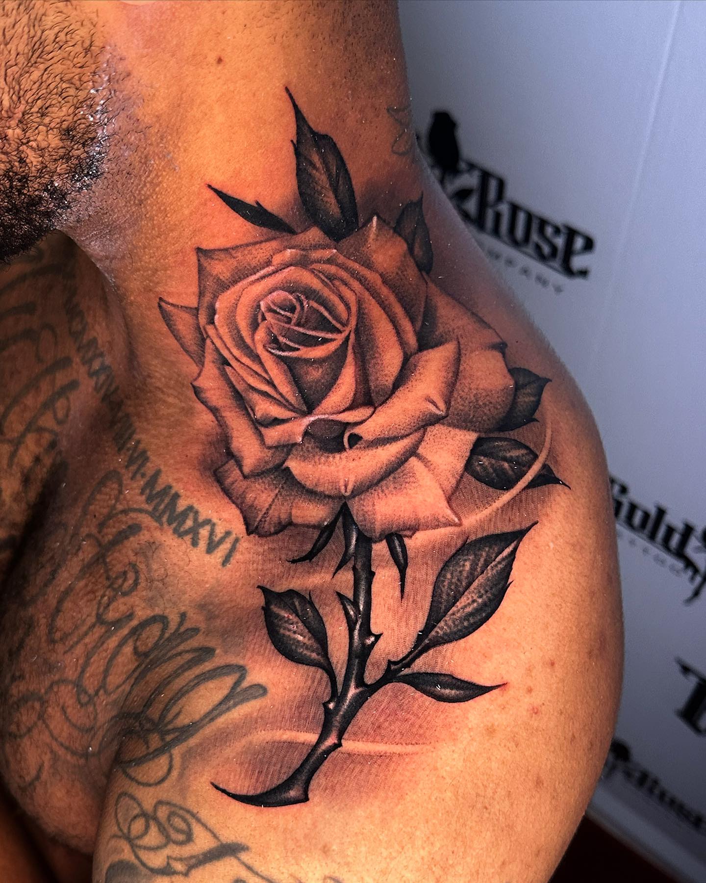Rose on Trapezius
